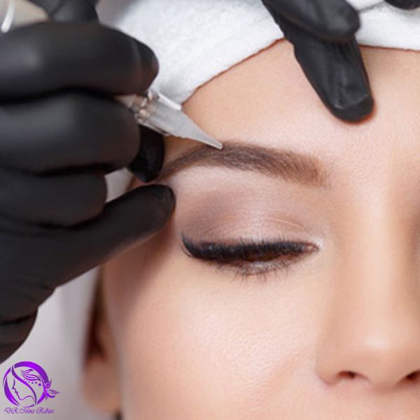 Eyebrow transplantation کاشت ابرو در کرج