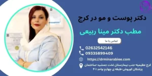 دکتر مو و ریزش مو در کرج