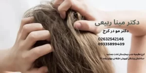 ریزش مو از استرس