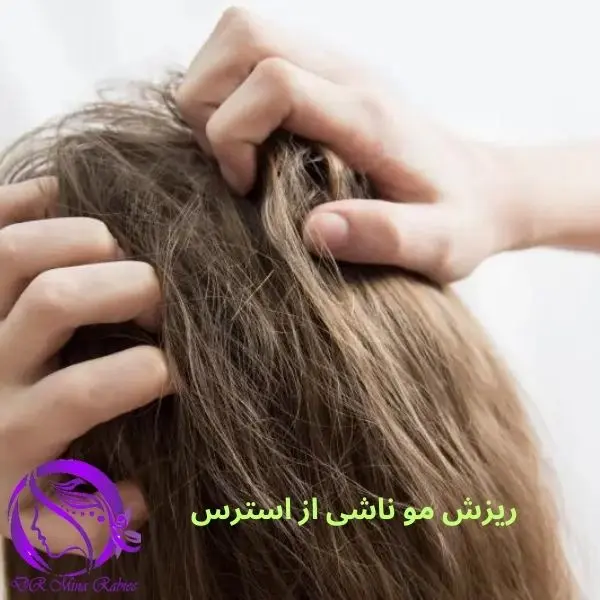 ریزش مو ناشی از استرس