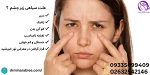 دلایل ایجاد سیاهی دور و زیر چشم