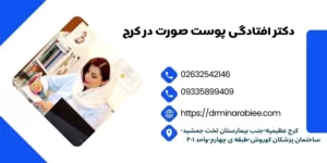 دکتر افتادگی پوست صورت در کرج