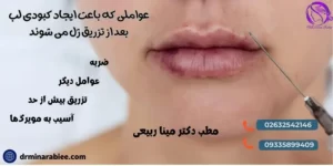 عوامل که باعث ایجاد کبودی لب بعد از تزریق ژل می شوند