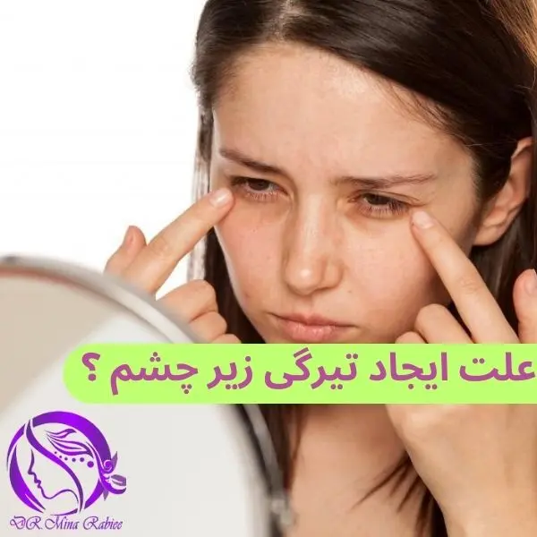 ایجاد علت تیرگی زیر چشم