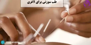 طب سوزنی و لاغری 