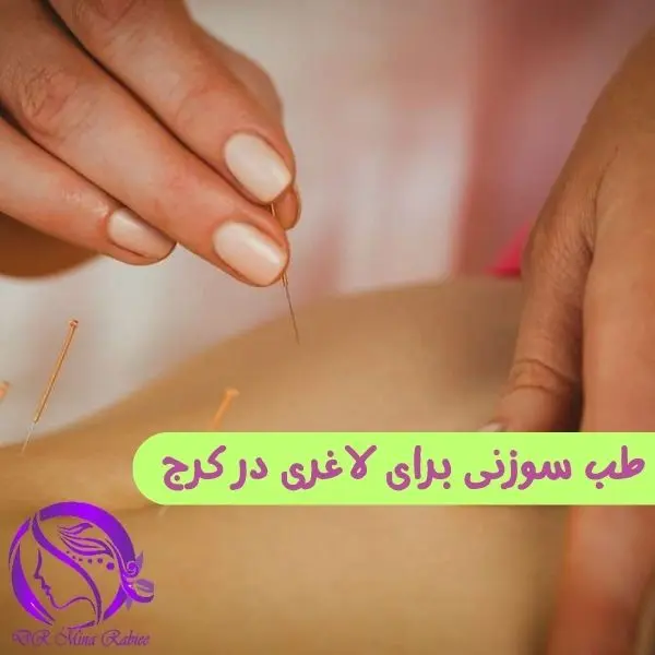 طب سوزنی برای لاغری در کرج