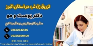 تزریق ژل لب آقایان در کرج 