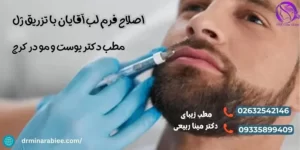 اصلاح فرم لب آقایان با تزریق ژل