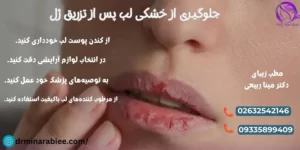 جلوگیری از خشکی لب پس از تزریق ژل