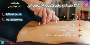 نقاط حساس برای لاغری با طب سوزنی