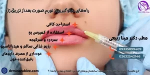 راه‌های جلوگیری از تورم صورت بعد از تزریق ژل