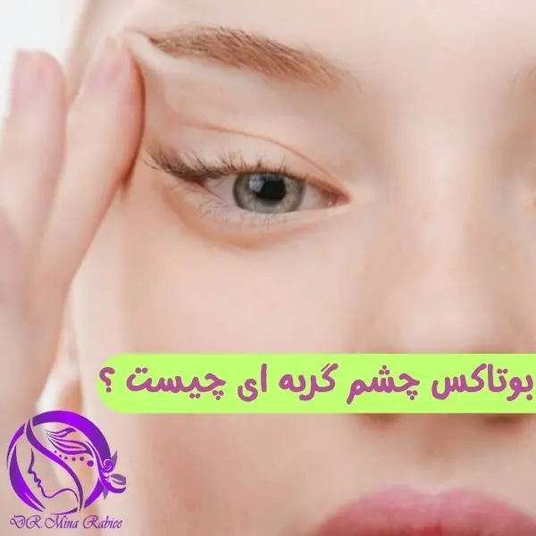 بوتاکس چشم گربه ای چیست و چه فوایدی دارد؟