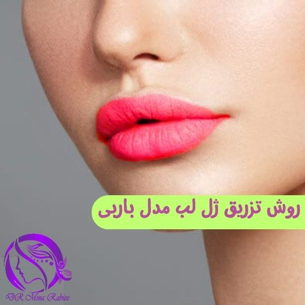 تزریق ژل لب مدل باربی