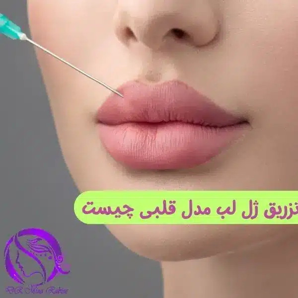 تزریق ژل لب مدل قلبی