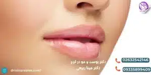 نحوه ماساژ بعد از تزریق ژل لب