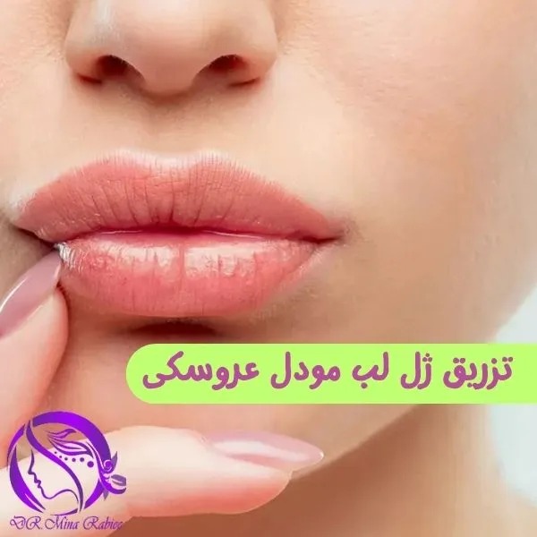 تزریق ژل لب عروسکی عکس