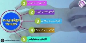 انواع اگزمای دست کدام است