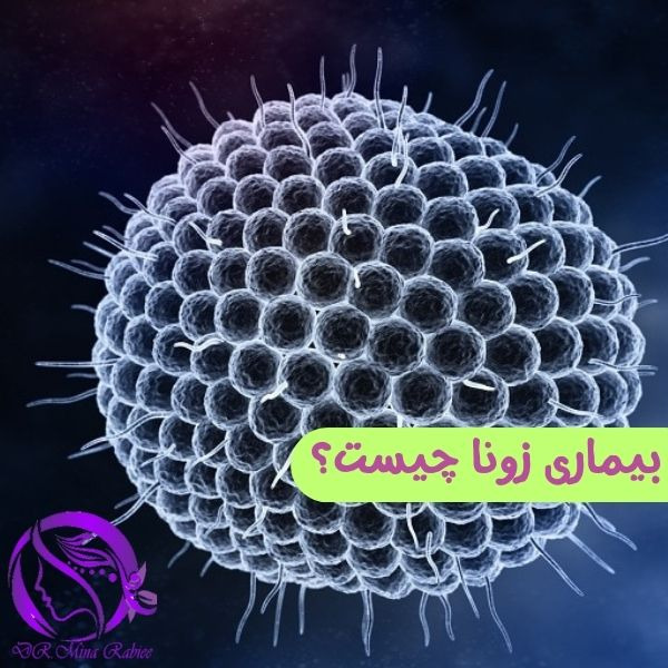 بهترین دکتربوتاکس در کرج