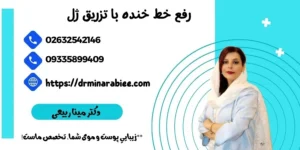 رفع خط خنده در کرج