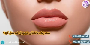 مدت زمان ماندگاری تزریق ژل لب مدل گرد؟