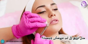 مدل تزریق ژل لب عروسکی