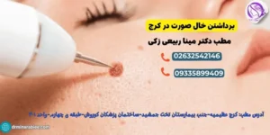 برداشتن خال صورت در کرج