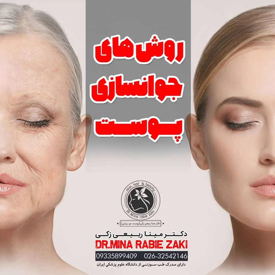 کربوکسی تراپی مطب دکتر مینا ربیعی 