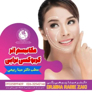 کربوکسی تراپی  مطب دکتر مینا ربیعی 