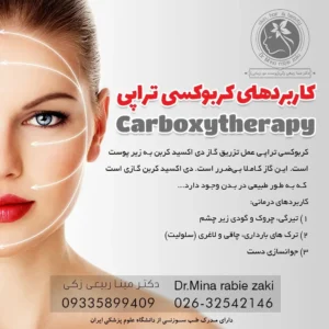 کاربردهای کربوکسی تراپی در عظیمیه کرج 